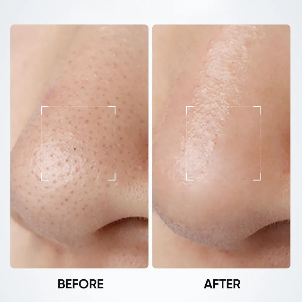 3-in-1 Charcoal Clay Stick for Blackhead Removal
