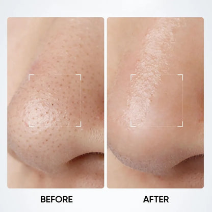 3-in-1 Charcoal Clay Stick for Blackhead Removal